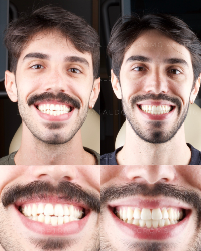 MENTORIA CASOS1
